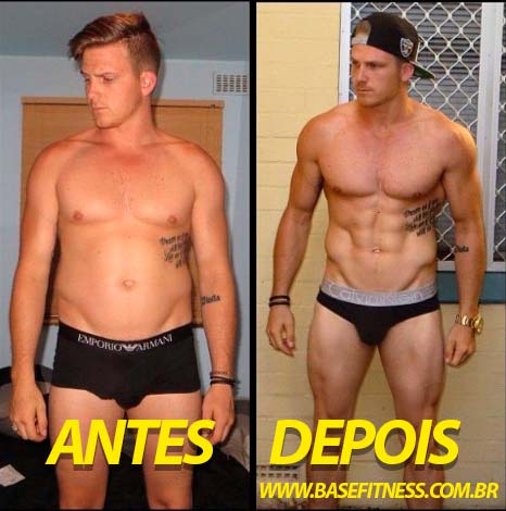 Antes e depois do ciclo do brônquio dilatador 