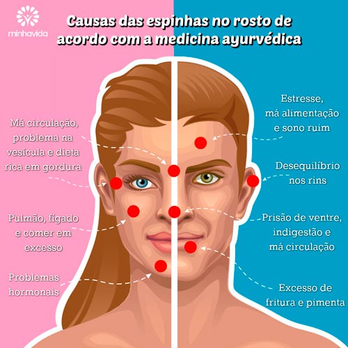 Razões da Acne no rosto