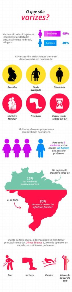 Infográfico sobre as varizes