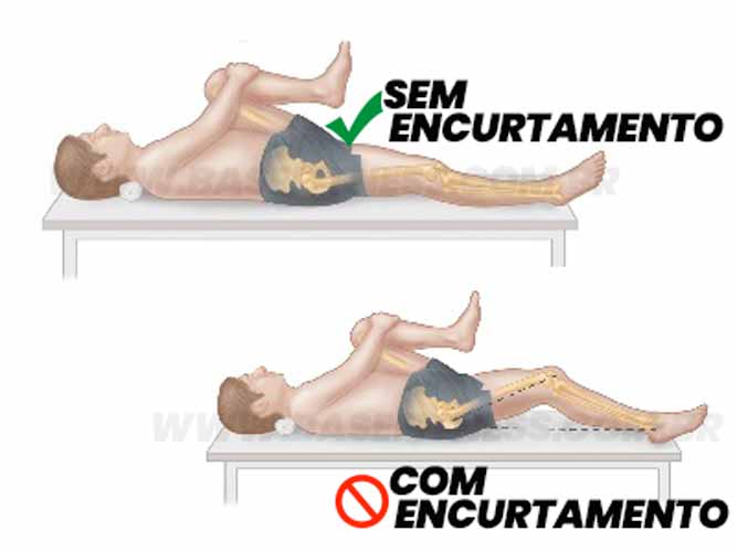 Teste de encurtamento muscular