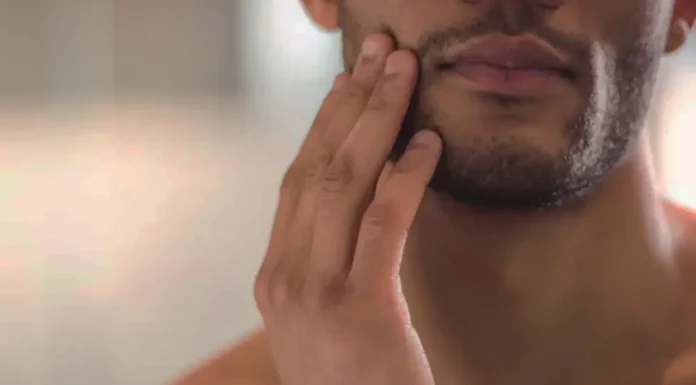 Hipercalórico Causa Acnes? Entenda a Relação entre Suplementos e Pele Hipercalórico causa acne?