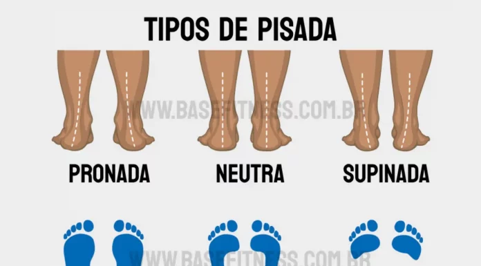 Tipos de pisada: descubra qual é a sua, evite lesões e escolha o tênis ideal TIPOS DE PISADA