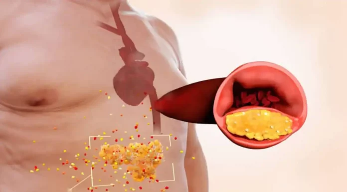 Inverter a ordem do treino queima mais gordura visceral, diz estudo Inverter a ordem do treino queima mais gordura visceral